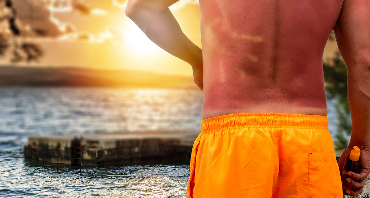 SANTÉ : INSOLATION : Aimer le soleil, oui! Mais jusqu’où?